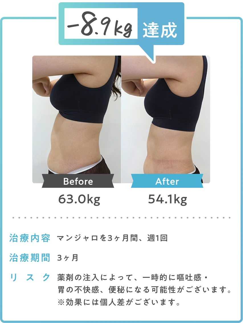 GLP-1なら無理せず効果を実感 -8.1kg達成