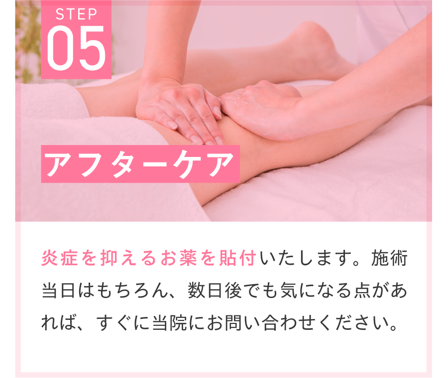 アフターケア