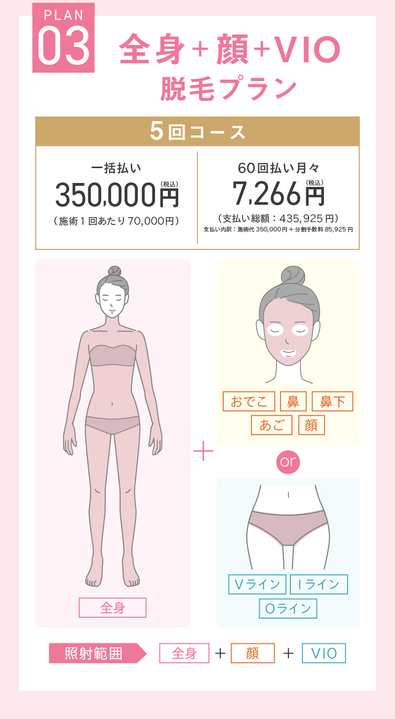 全身+顔+VIO脱毛プラン
