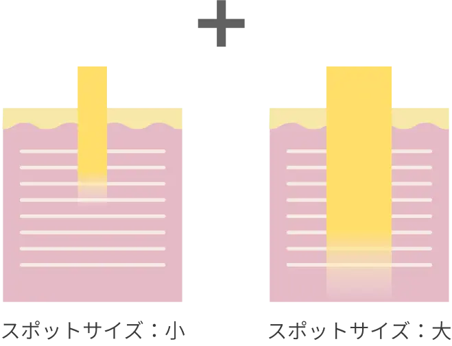 スポットサイズスポットサイズ