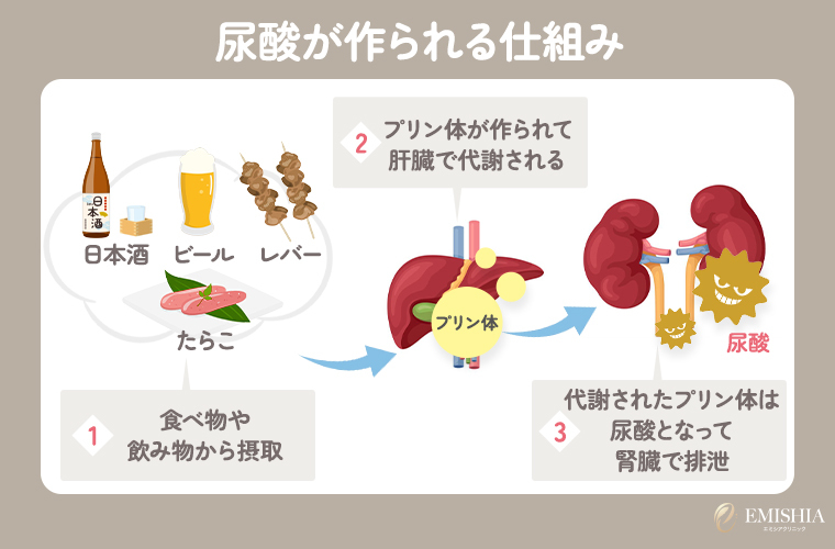 尿酸が作られる仕組み