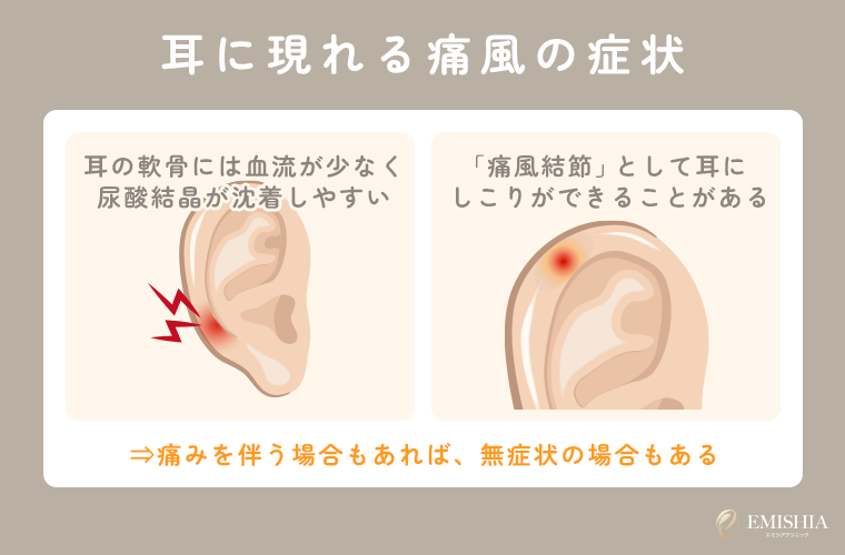 耳に症状が出る理由