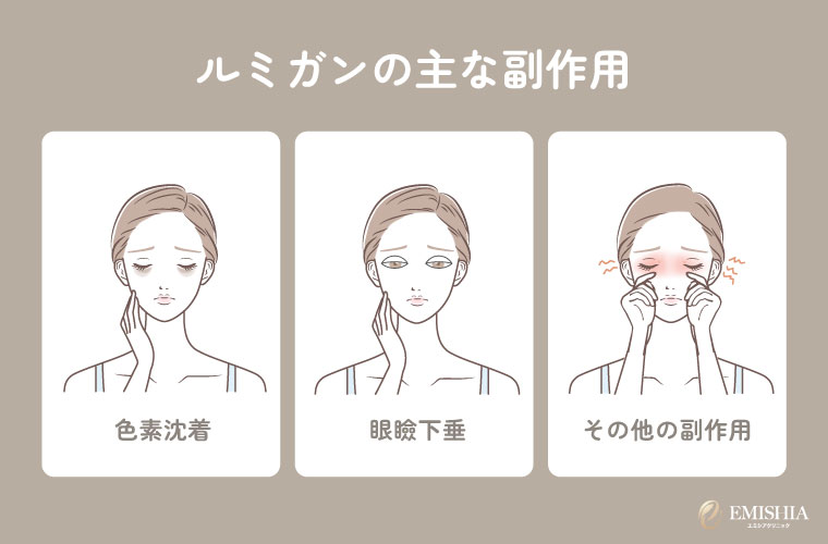 ルミガンの主な副作用