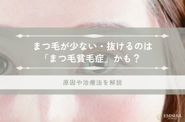 まつ毛が少ない・抜けるのは「まつ毛貧毛症」かも？原因や治療法を解説