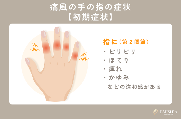 痛風になった手の指の初期症状