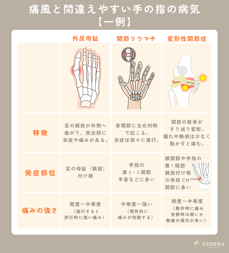 痛風と間違えやすい手の指の病気
