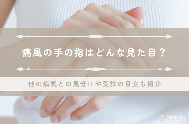 痛風が手の指に現れたときの見た目を写真で確認！他の病気との見分けや受診の目安も紹介